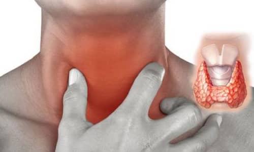 Если знать, как проверить щитовидку в домашних условиях, и регулярно проводить самостоятельную диагностику, можно вовремя заметить признаки эндокринных нарушений