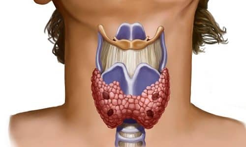 Щитовидная железа в нормальном состоянии напоминает по форме бабочку, она гладкая и не видна на шее
