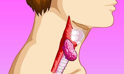Как известно, 95% узлов щитовидного органа — это доброкачественные опухоли, которые не представляют опасности для жизни пациента