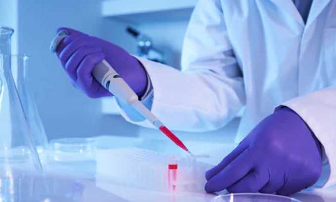 Лабораторные исследования крови определяют уровень гормонов Т3, Т4, который в данном случае снижен