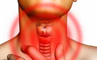 Что представляет собой коллоидный узел щитовидной железы?