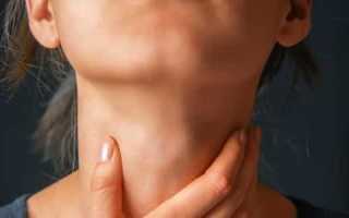 Эффективное лечение узлов щитовидной железы народными средствами