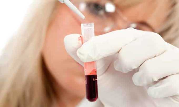 Обязательным является анализ крови на уровень гормонов (ТТГ, Т3, Т4), а также наличие антител к тиреоглобулину и тиреоидной пероксидазе