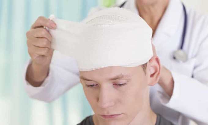 Тяжелые черепно-мозговые травмы с повреждением гипоталамуса могут стать причиной снижения тироксина