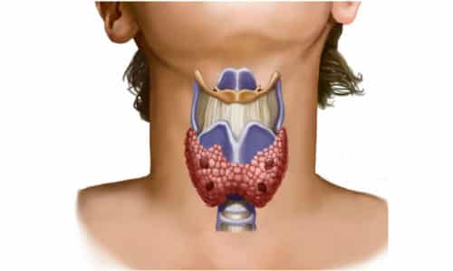 Отличительная особенность заболеваний щитовидной железы заключается в их бессимптомном течении на ранних стадиях развития